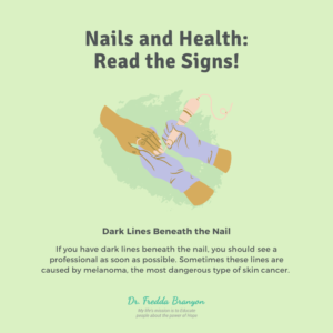 Dark Lines Beneath the Nail Image