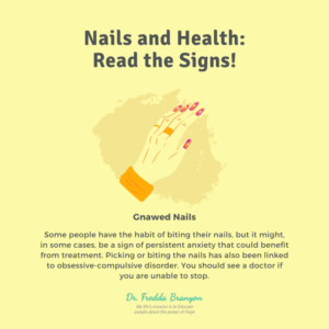 Gnawed Nails Image