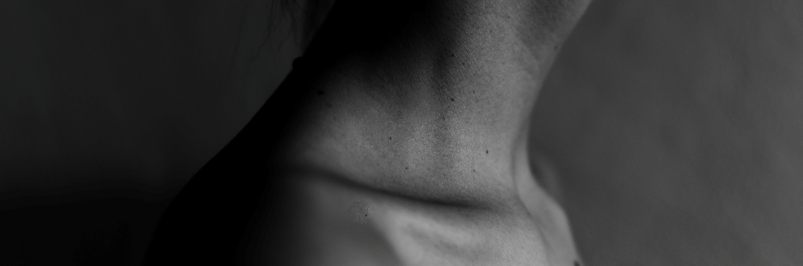 Seborrheic Keratoses