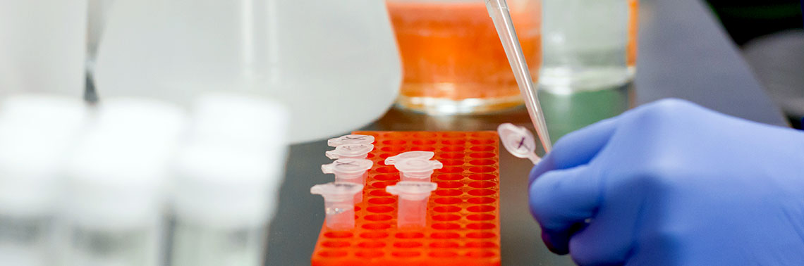 Enzyme Defines Colon Cancer