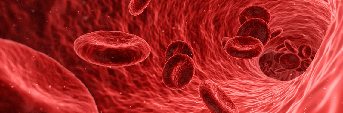 What IS Myelodysplastic Syndrome?