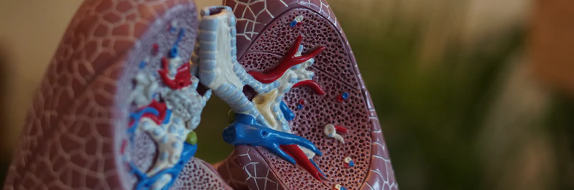 Fat Build-Up in Lungs